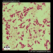 ecoli and campylobacter under microscope